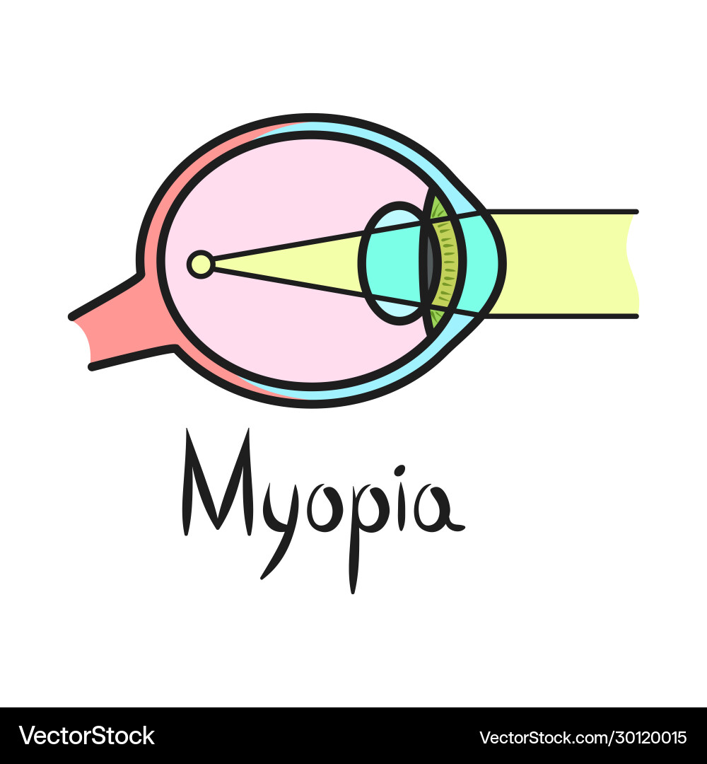 Design myopia and eye icon web element Design myopia and eye icon web element vector image