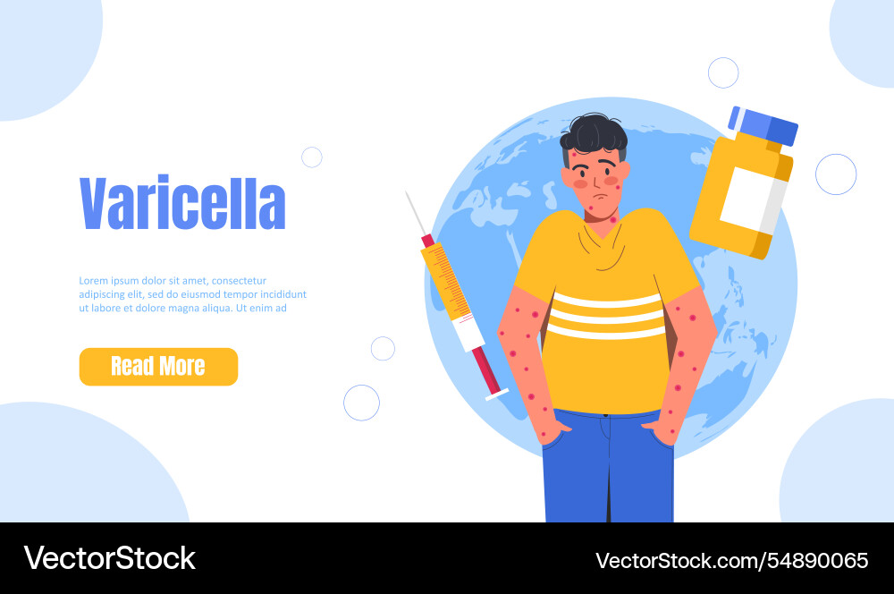Varicella Impfstoff Poster Junge in roten Flecken Varicella Impfstoff Poster Junge in roten Flecken vektorbild