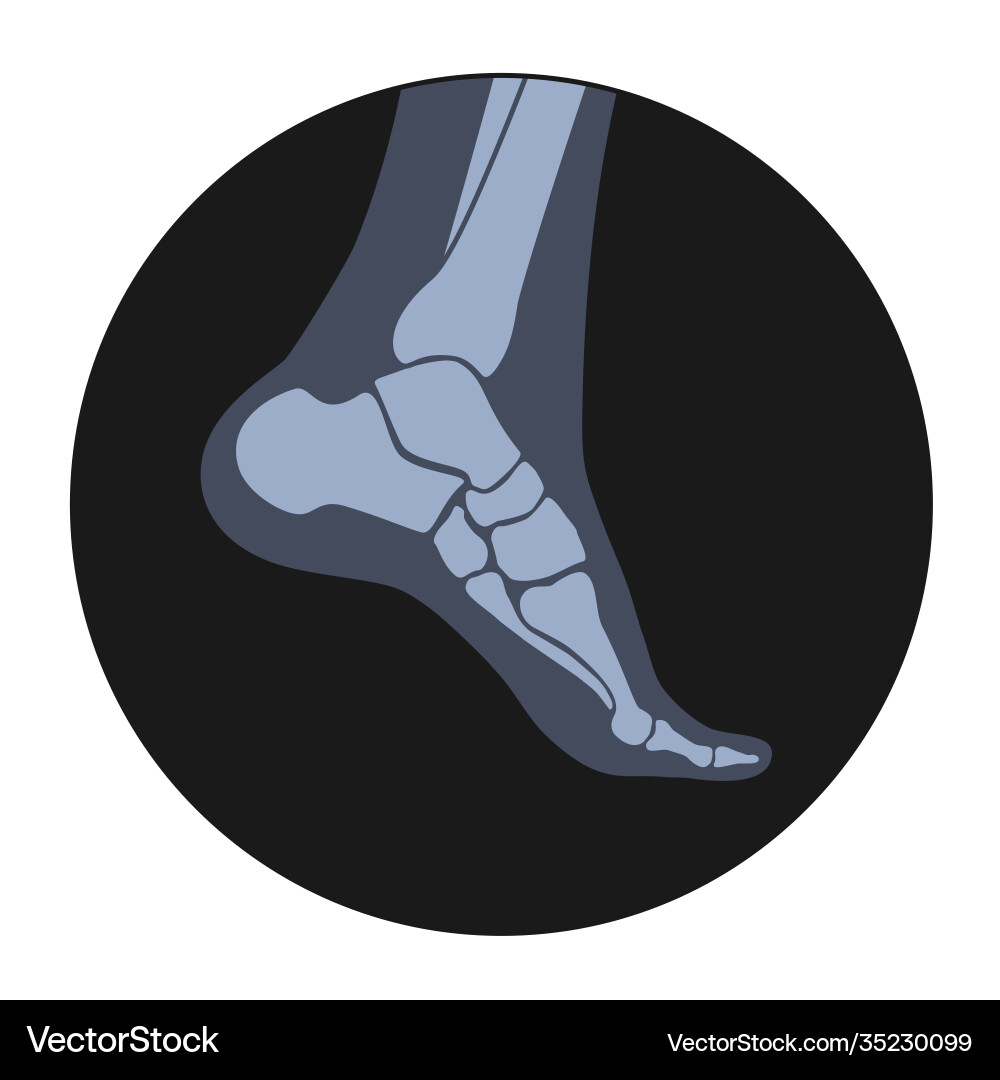 Human bones concept Royalty Free Vector Image - VectorStock