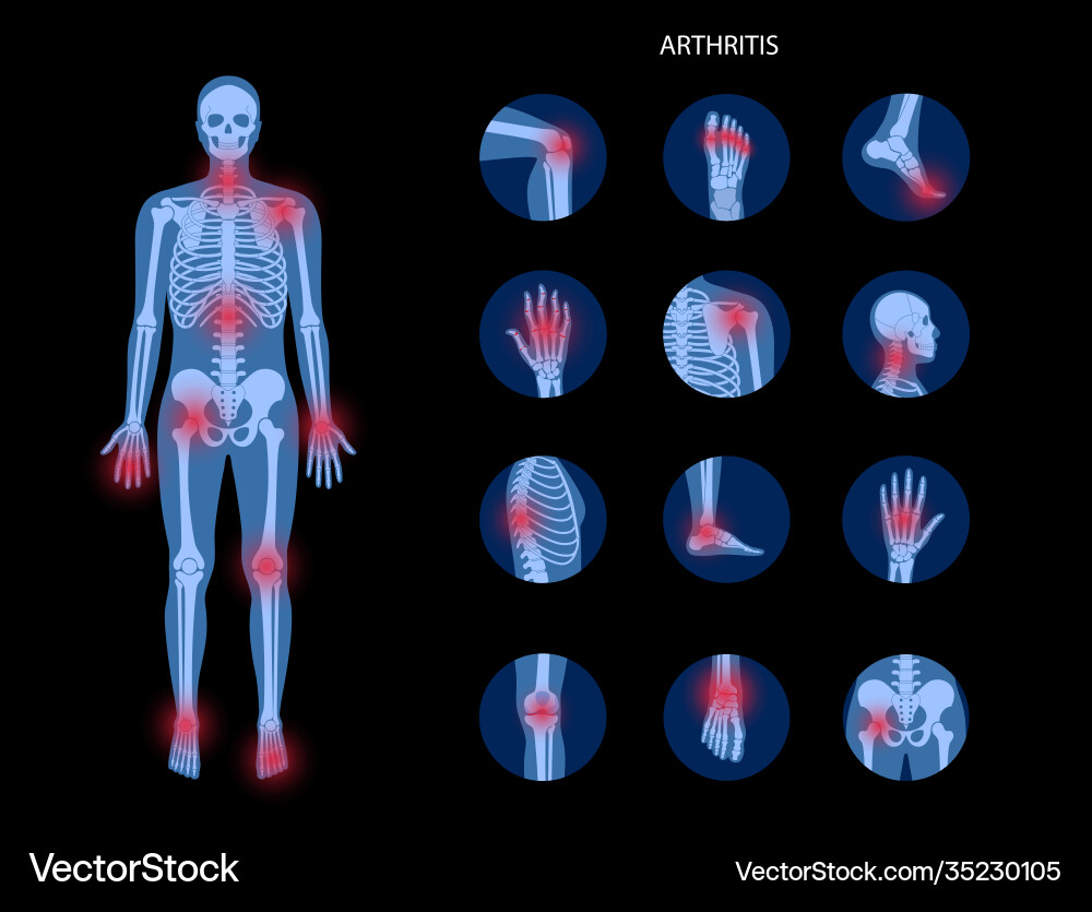 Human bones concept Royalty Free Vector Image - VectorStock