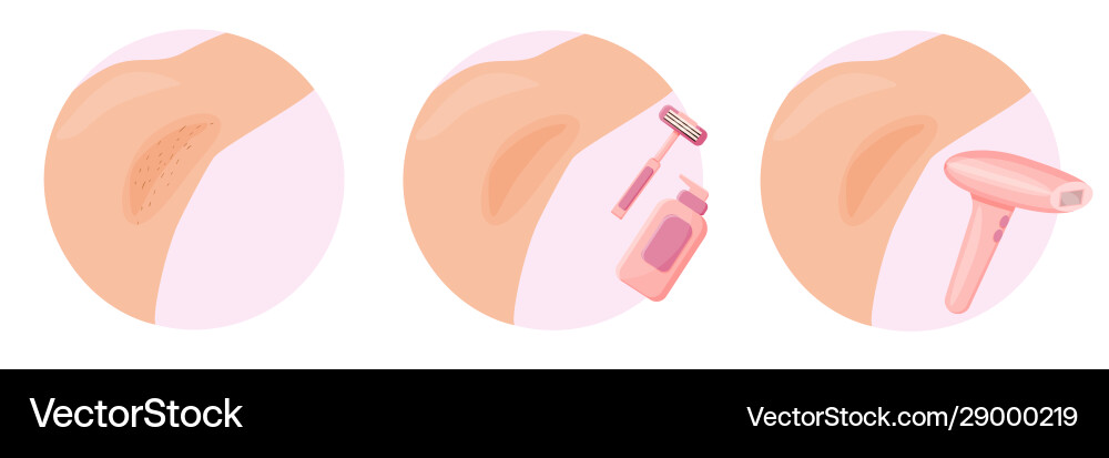 Epilation and depilation armpits different methods Epilation and depilation armpits different methods Vector Image