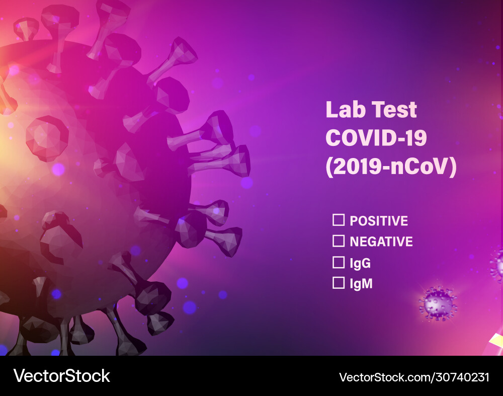 Lab test check list on covid-19 computer model Lab test check list on covid-19 computer model vector image