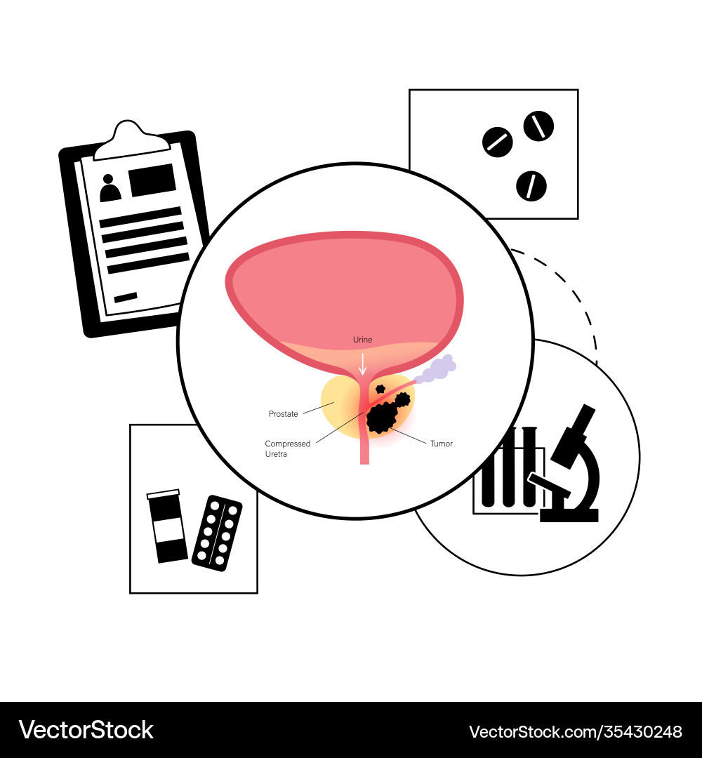 Man reproducive system problems Man reproducive system problems vector image