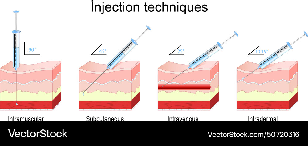 Injection methods intramuscular subcutaneous Vector Image