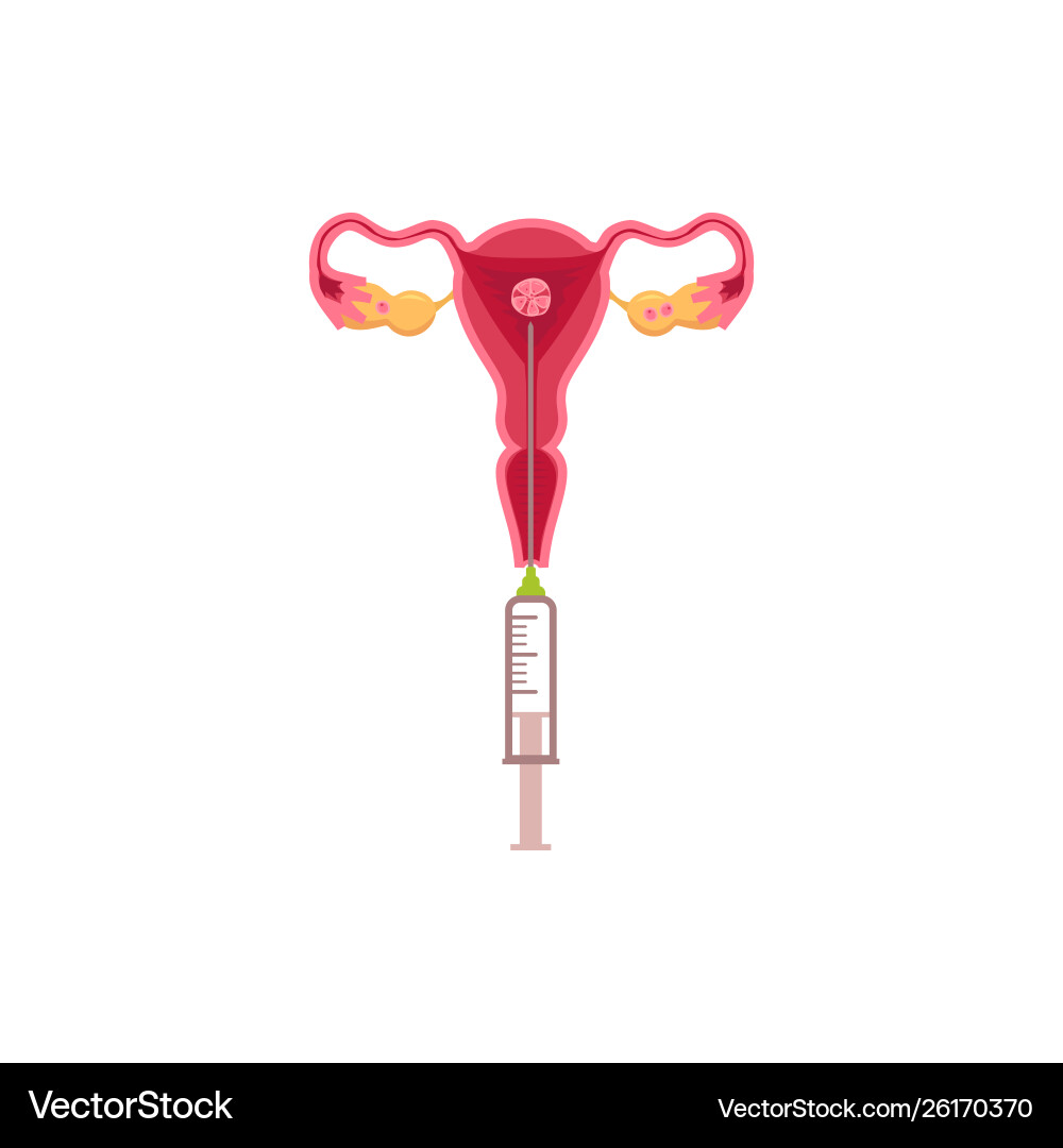 Artificial insemination and introduction a ovum Artificial insemination and introduction a ovum vector image