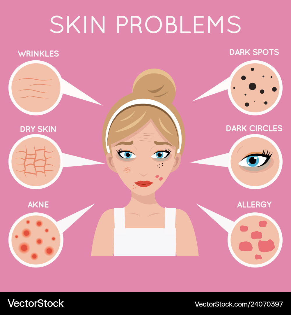 Skin problems face women cosmetic care problem Skin problems face women cosmetic care problem vector image