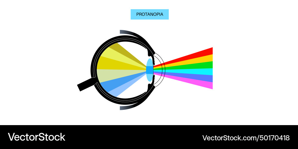 Protanomaly and protanopia Protanomaly and protanopia vector image