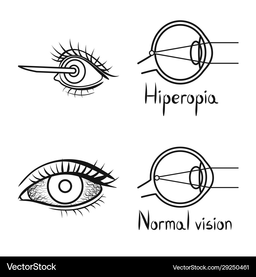 Isolated object correction and optometry sign Vector Image