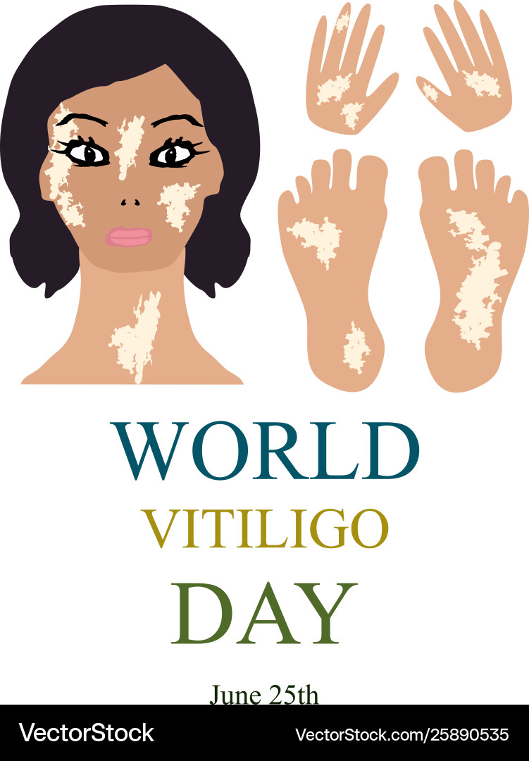 Welt vitiligo Tag Infografiken Welt vitiligo Tag Infografiken vektorbild