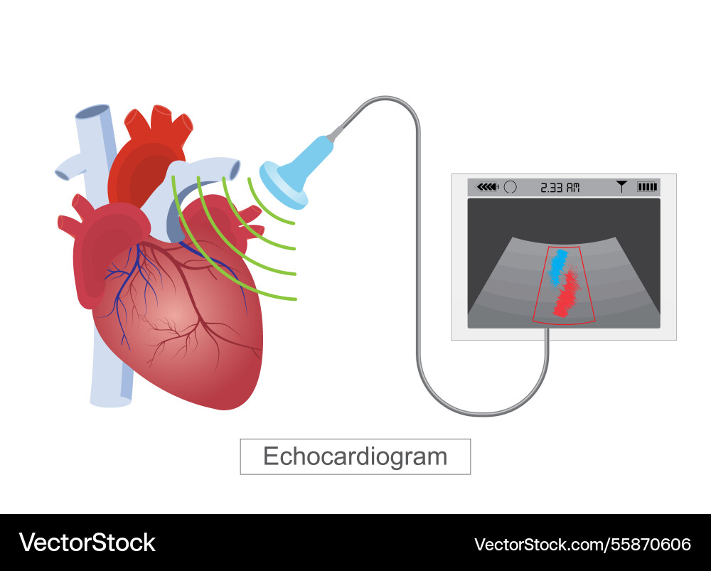 An echocardiogram echo is a test that use high An echocardiogram echo is a test that use high vector image
