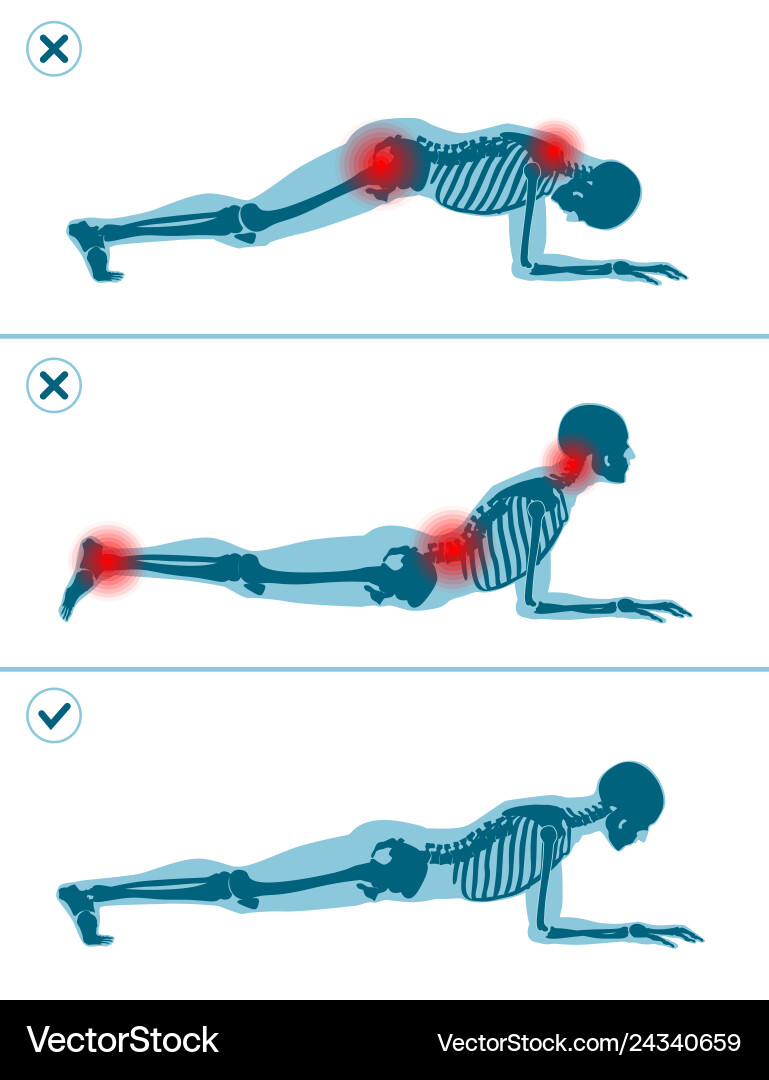 Plank Exercise: Correct vs. Incorrect Position Vector Image