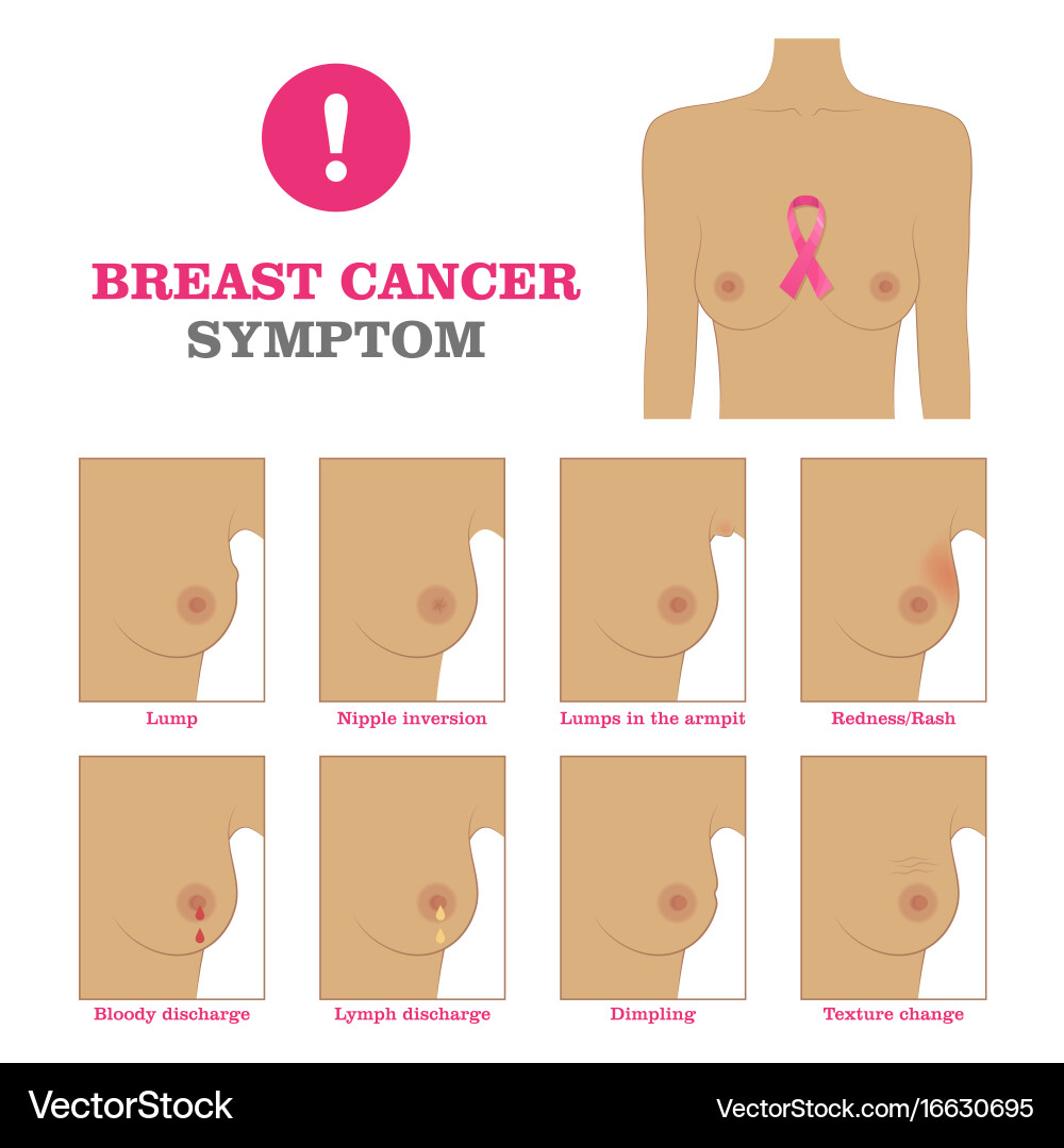 Breast cancer symptom Vector Image