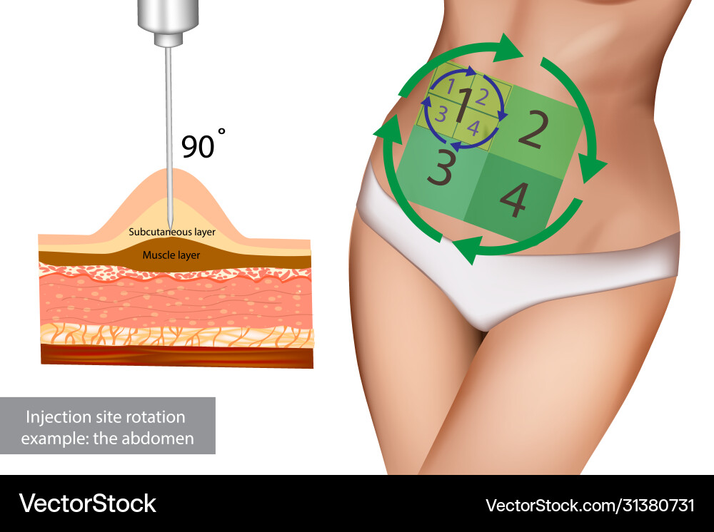 Injection site rotation example abdomen Injection site rotation example abdomen vector image