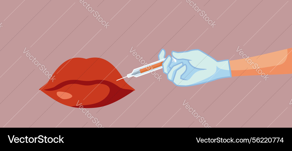 Ästhetisch injizieren Füllstoff in Lippen Ästhetisch injizieren Füllstoff in Lippen vektorbild