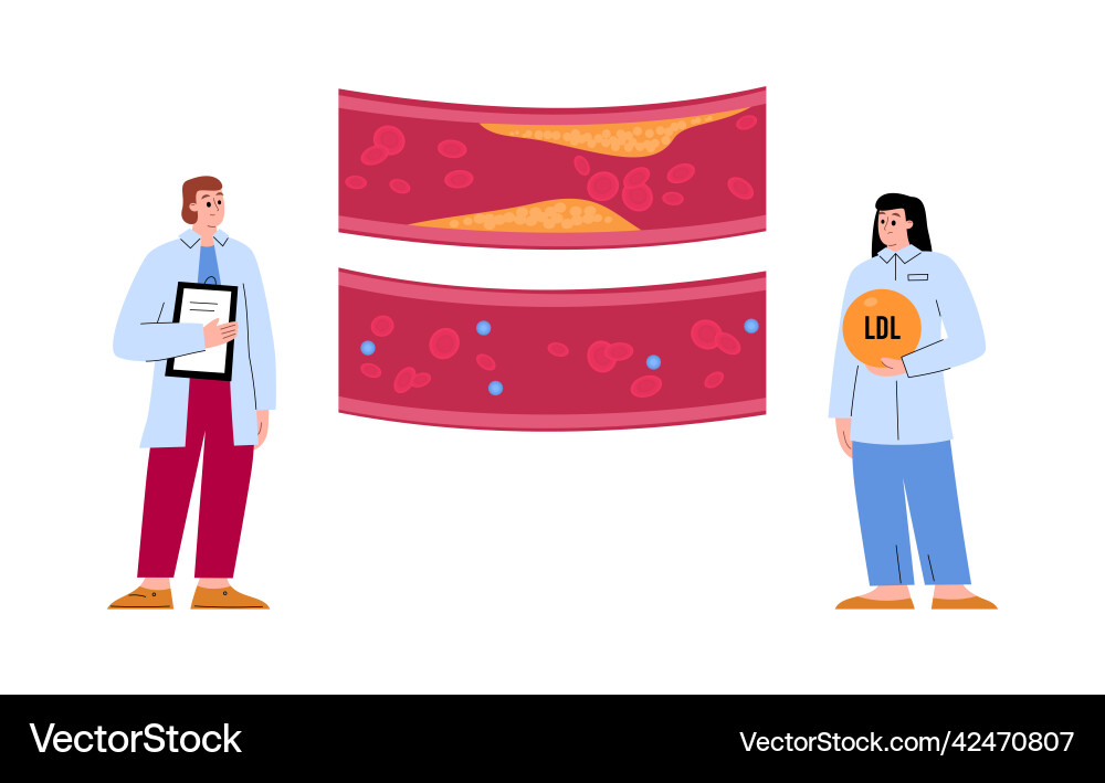 Doctors check cholesterol and vein patency flat Doctors check cholesterol and vein patency flat vector image