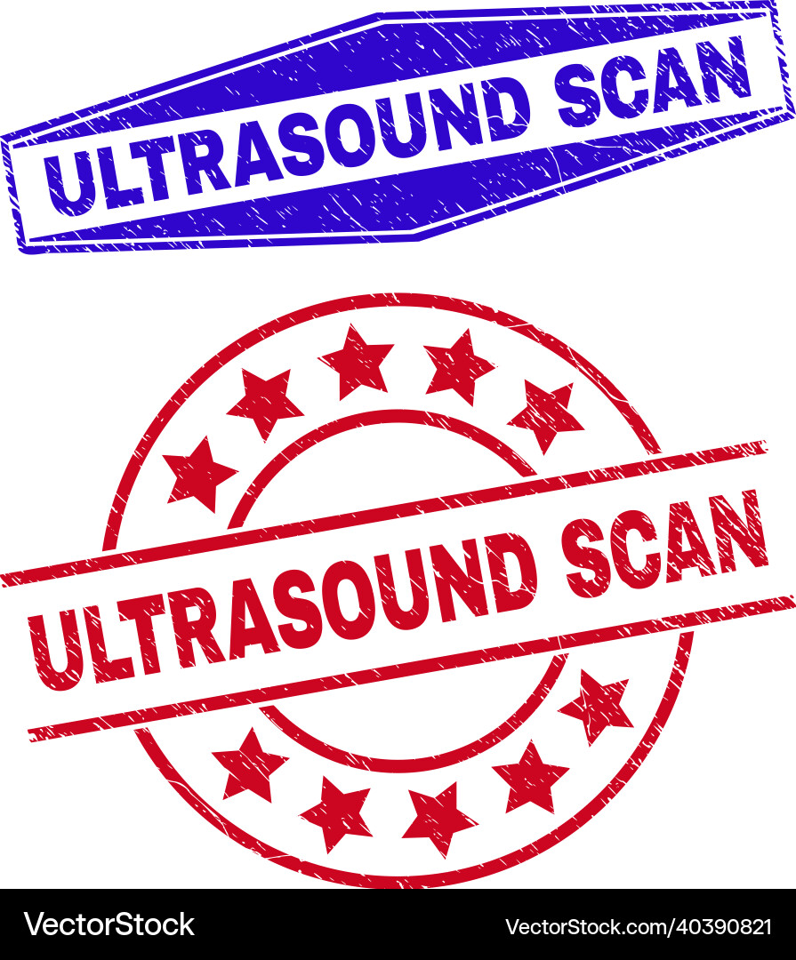 Ultrasound scan unclean seals in round Ultrasound scan unclean seals in round vector image