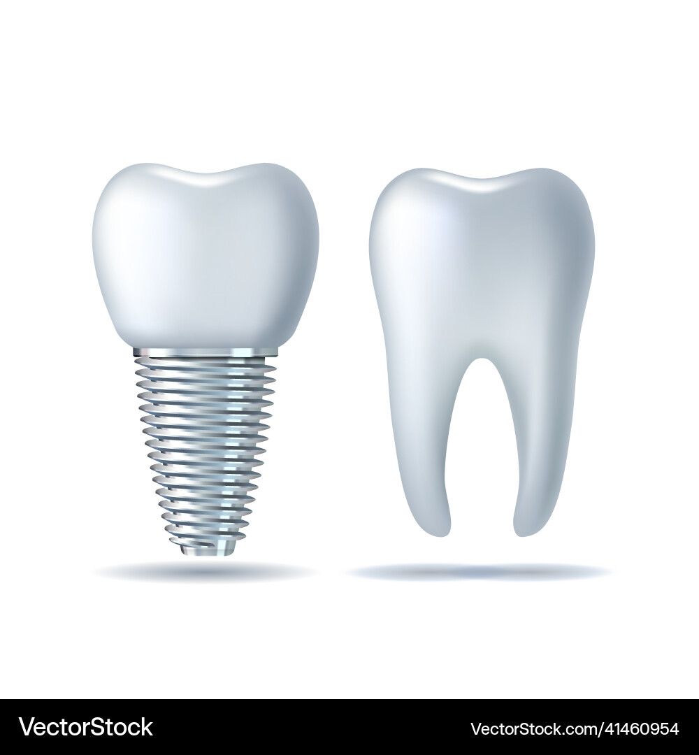 3d realistic white tooth and dental implant 3d realistic white tooth and dental implant vector image