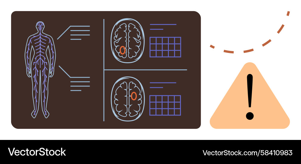 Brain Scan Analysis with Alert Signal Vector Image