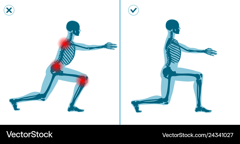 Wrong and correct lunges exercise right execution Wrong and correct lunges exercise right execution vector image