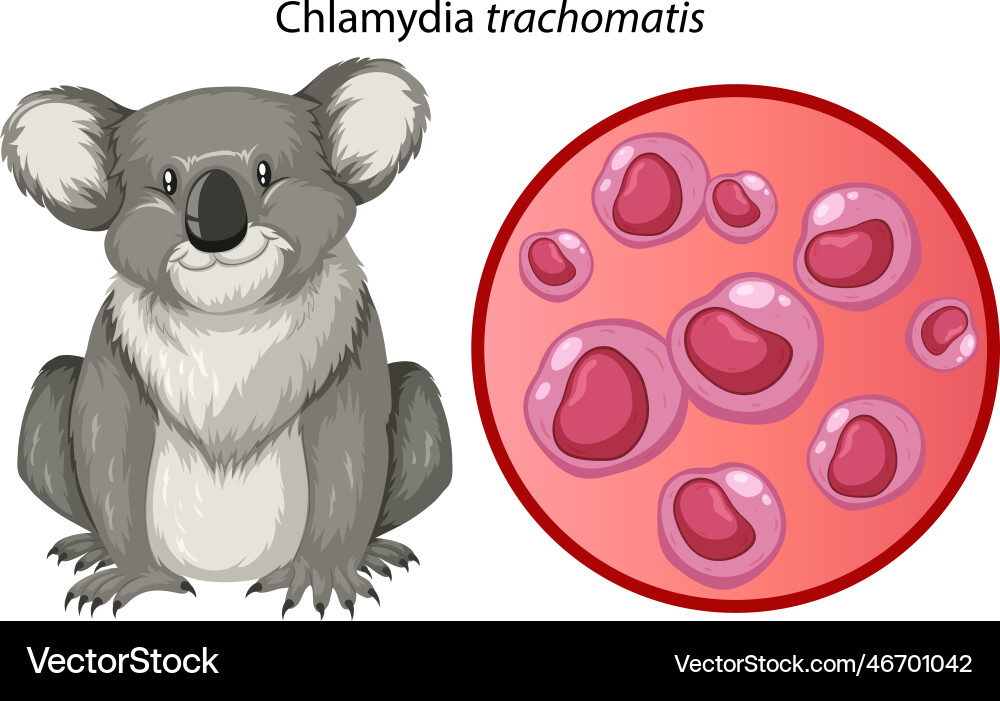Chlamydia trachomatis with explanation Vector Image