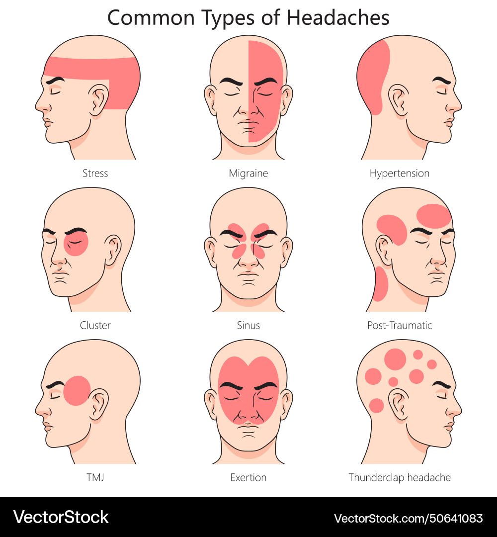 human-headache-anatomy-diagram-royalty-free-vector-image