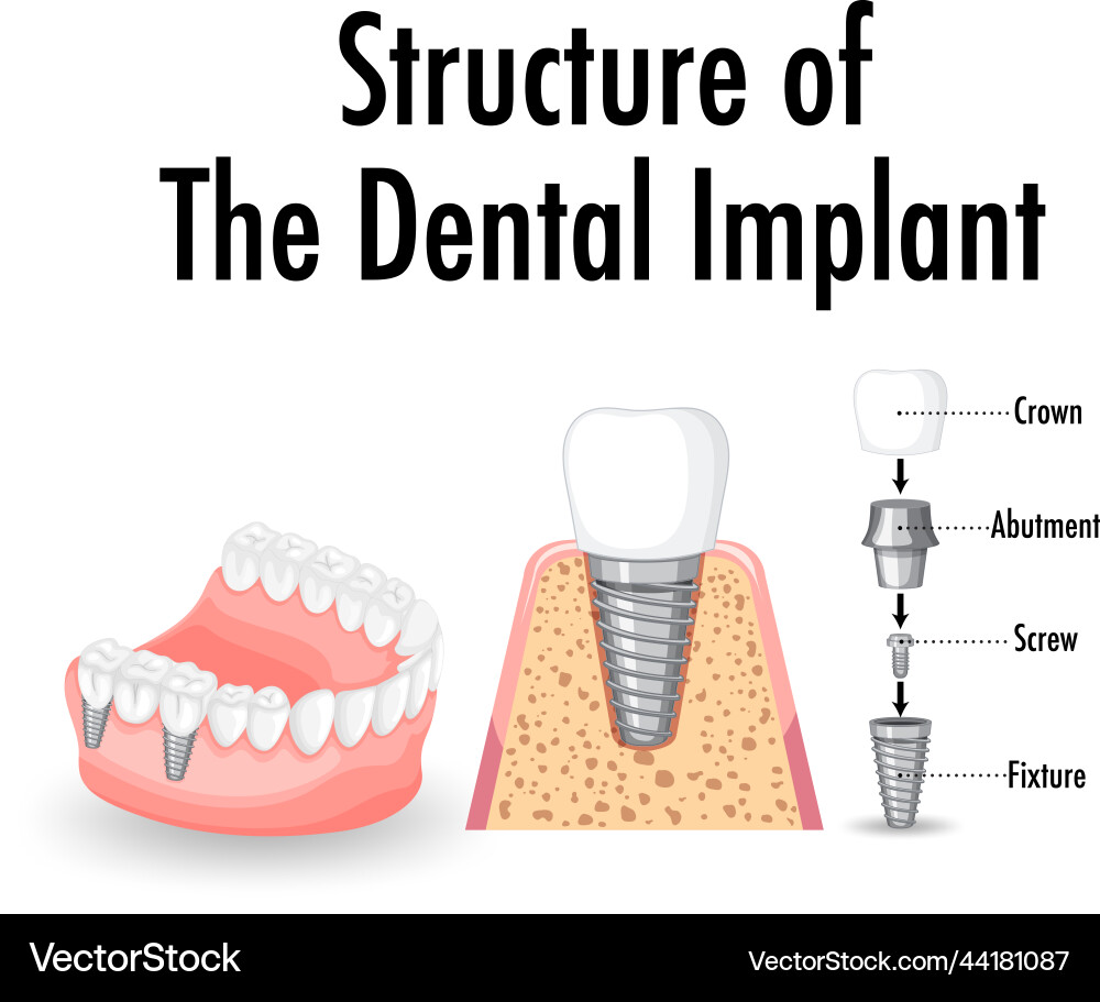 Infographic of human in structure the dental vector image