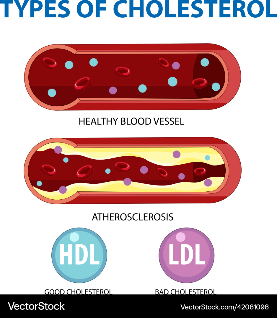 Types of cholesterol hdl and ldl Types of cholesterol hdl and ldl Vector Image