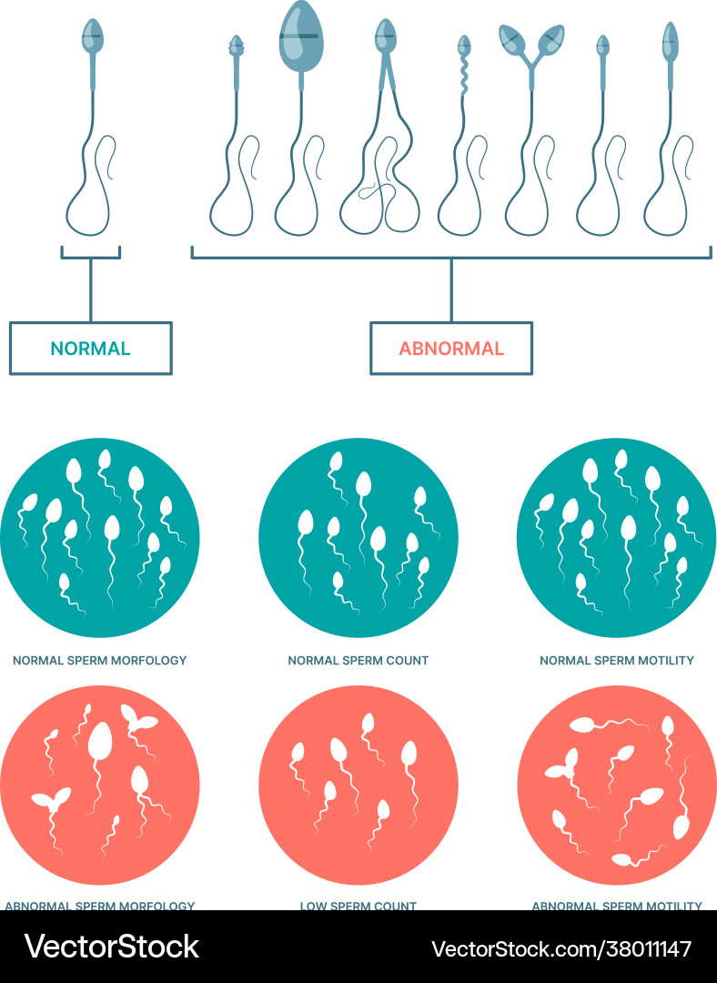 Teleboshlovchilar, qoshiqchilar va rassomlar yalangoch va yalangoch. Rus ayollarning katta eshaklari fotosuratlari