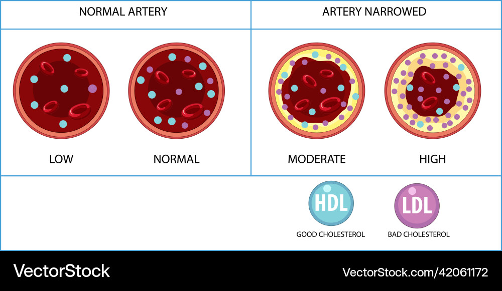 Types of cholesterol hdl and ldl Types of cholesterol hdl and ldl Vector Image