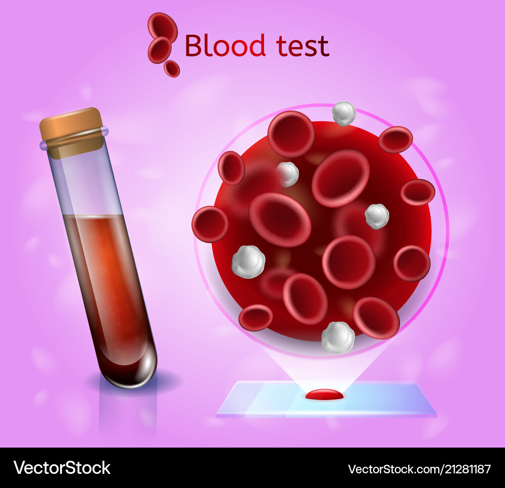Laboratory blood test realistic concept Laboratory blood test realistic concept vector image