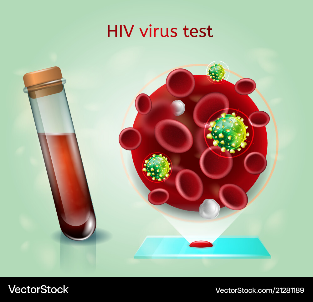 Hiv virus blood test realistic concept Hiv virus blood test realistic concept vector image
