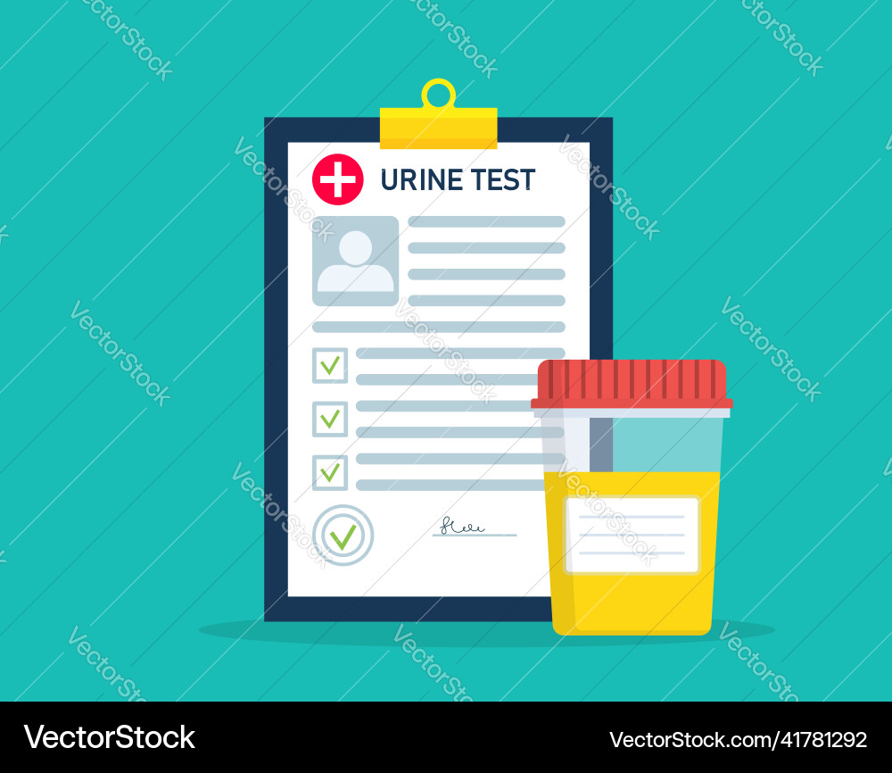 Urine Analysis Test Jar with Result Form vector image