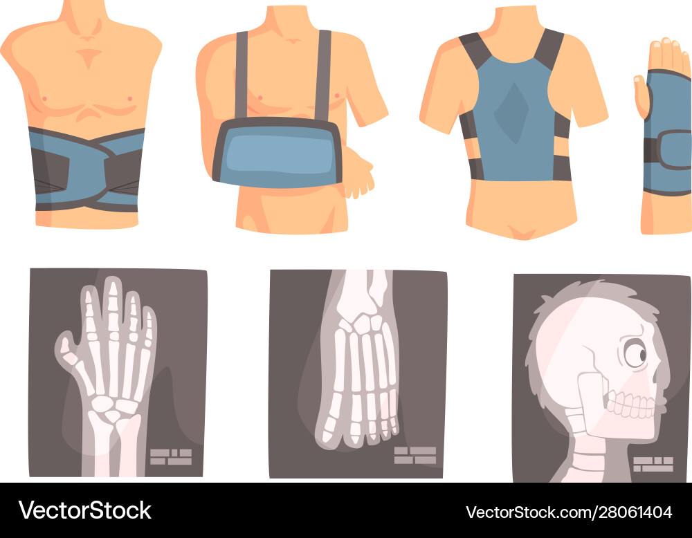 Different types bandage and xrays set Different types bandage and xrays set vector image