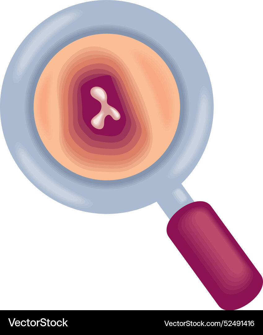 Multiple Myeloma Bone Marrow Cancer Royalty Free Vector