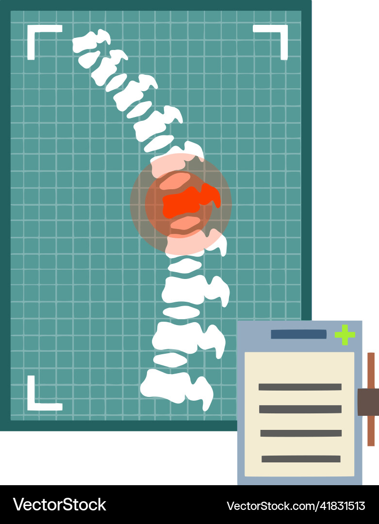 Problems with spine posture issues Problems with spine posture issues vector image