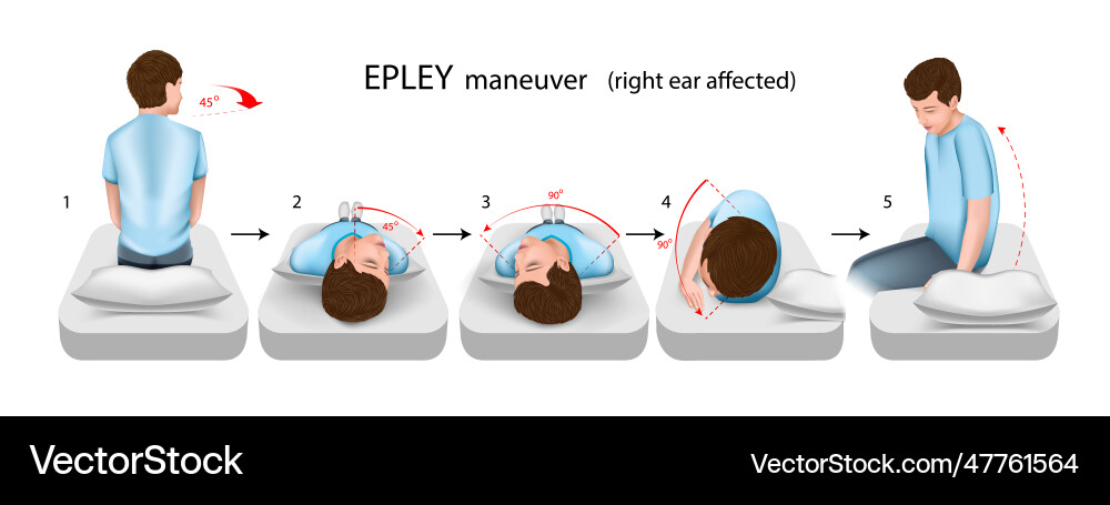 Epley maneuver right ear affected Epley maneuver right ear affected vector image