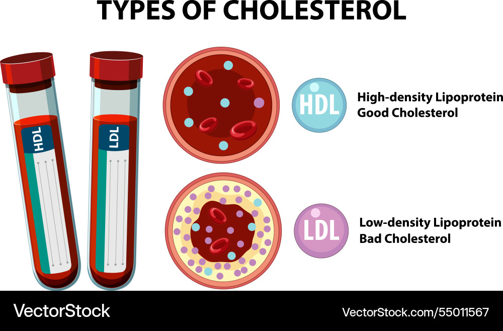 Hdl and ldl cholesterol differences Hdl and ldl cholesterol differences Vector Image