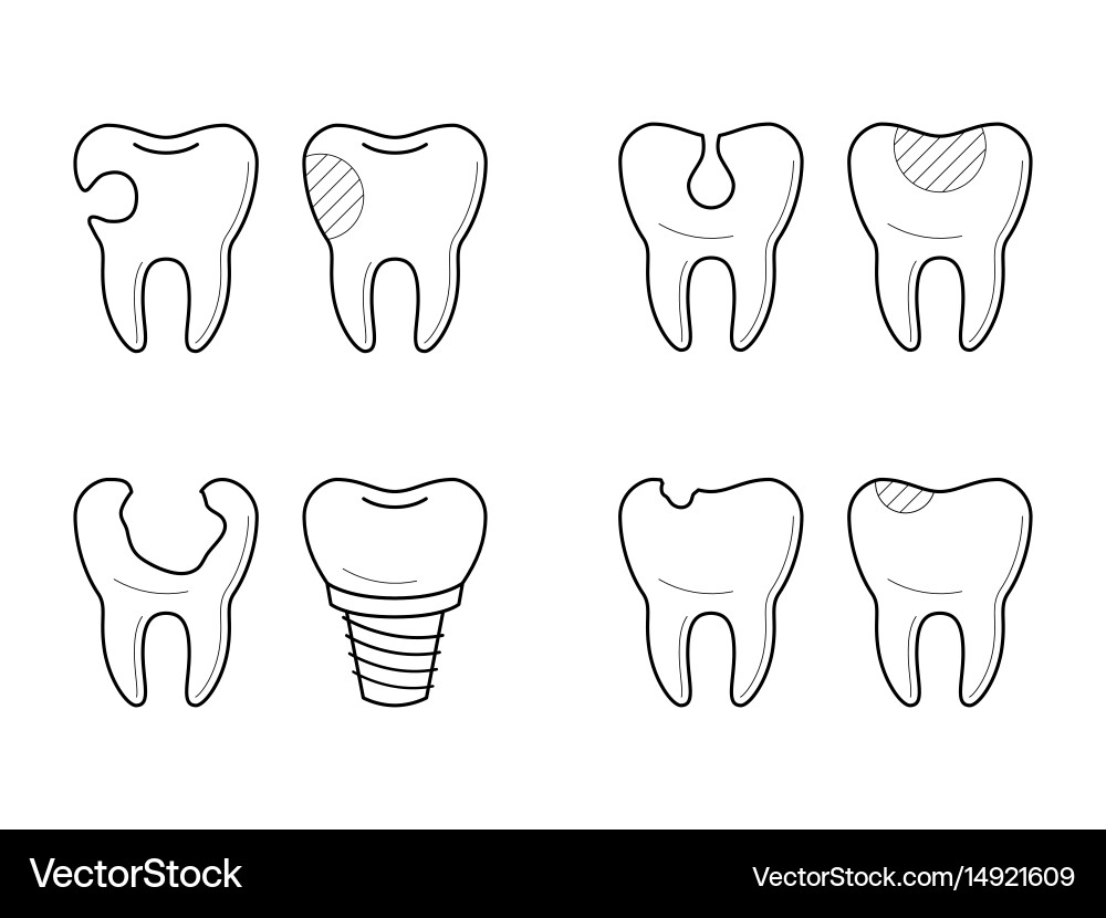 Icons of tooth treatment reconstruction Royalty Free Vector