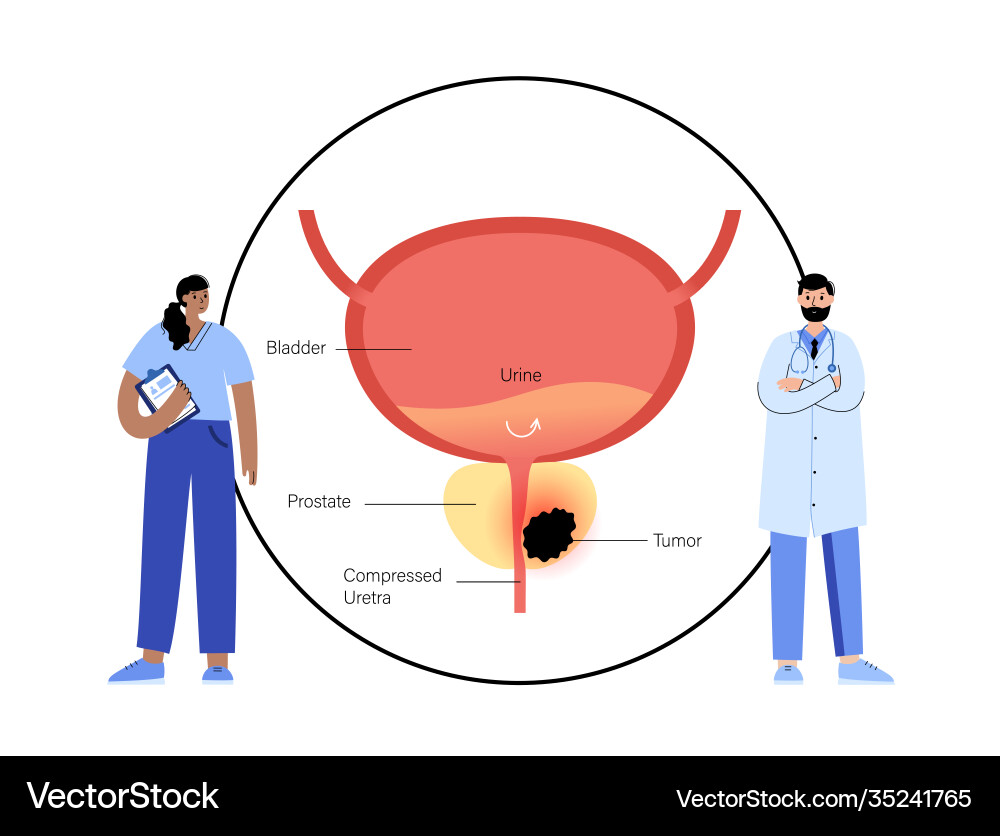 Man reproducive system problems Man reproducive system problems vector image