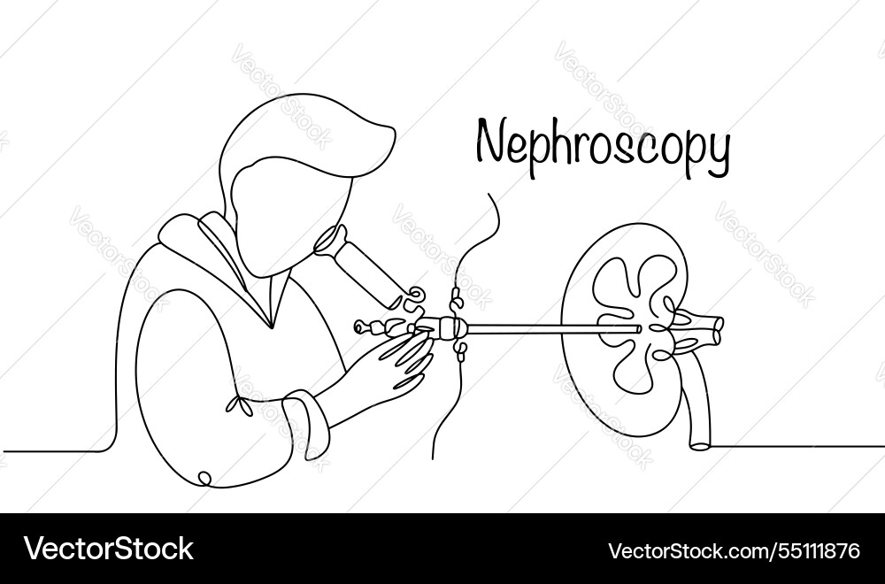 Kidney Examination Vector Image