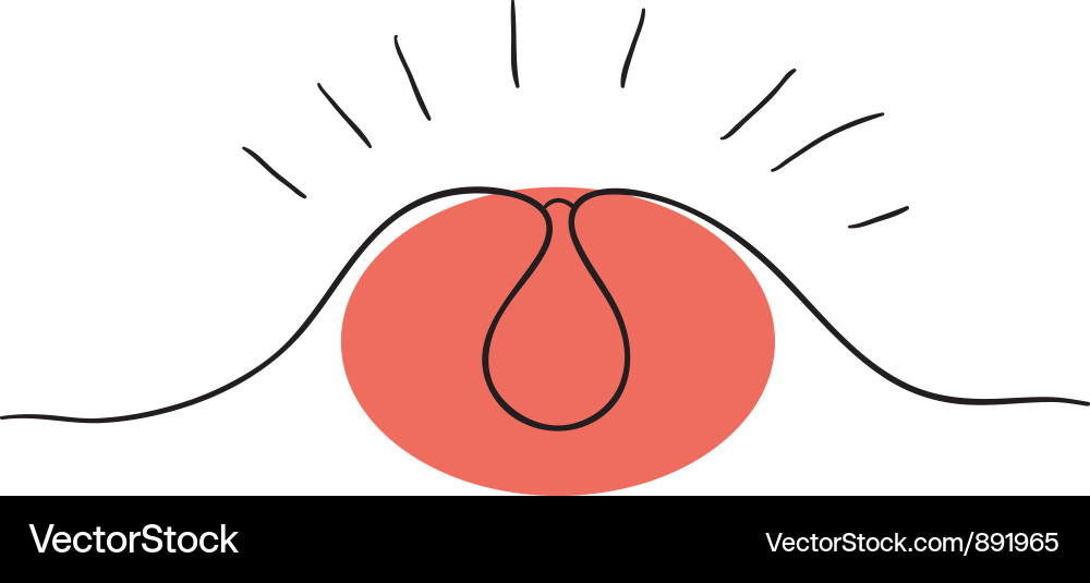Pimple Vector Image