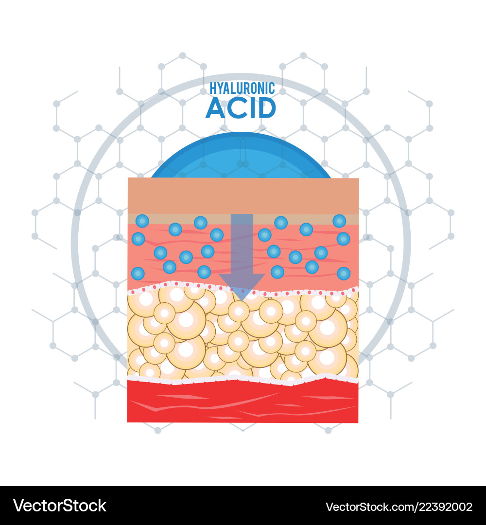 Hyaluronic acid filler injection infographic Hyaluronic acid filler injection infographic vector image