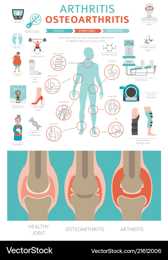 Joints diseases arthritis osteoarthritis symptoms Joints diseases arthritis osteoarthritis symptoms vector image