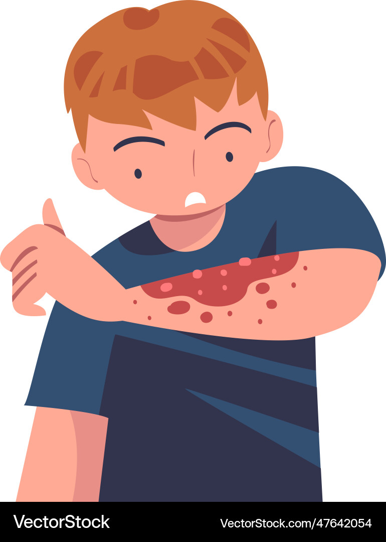 Man character with skin problem suffering from vector image