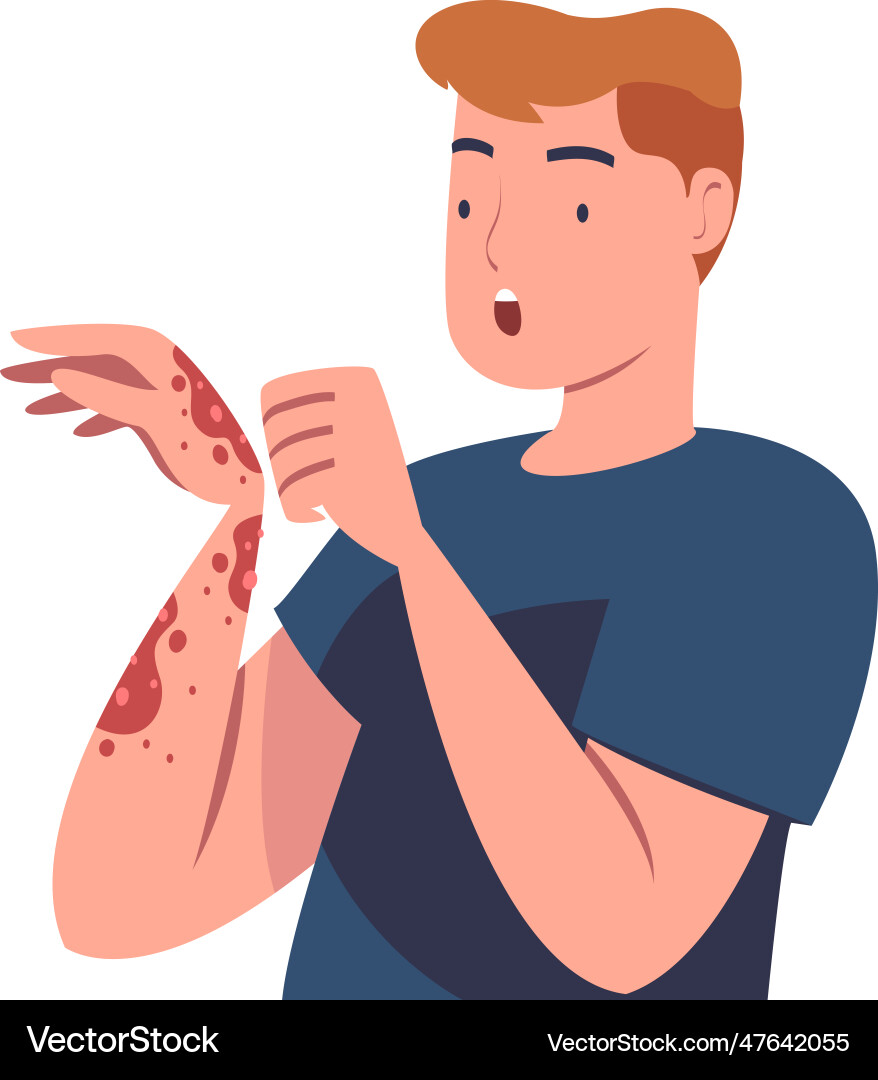 Man character with skin problem suffering vector image