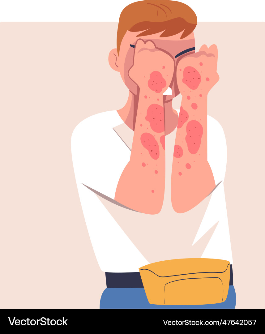 Man character with skin problem suffering from Man character with skin problem suffering from vector image