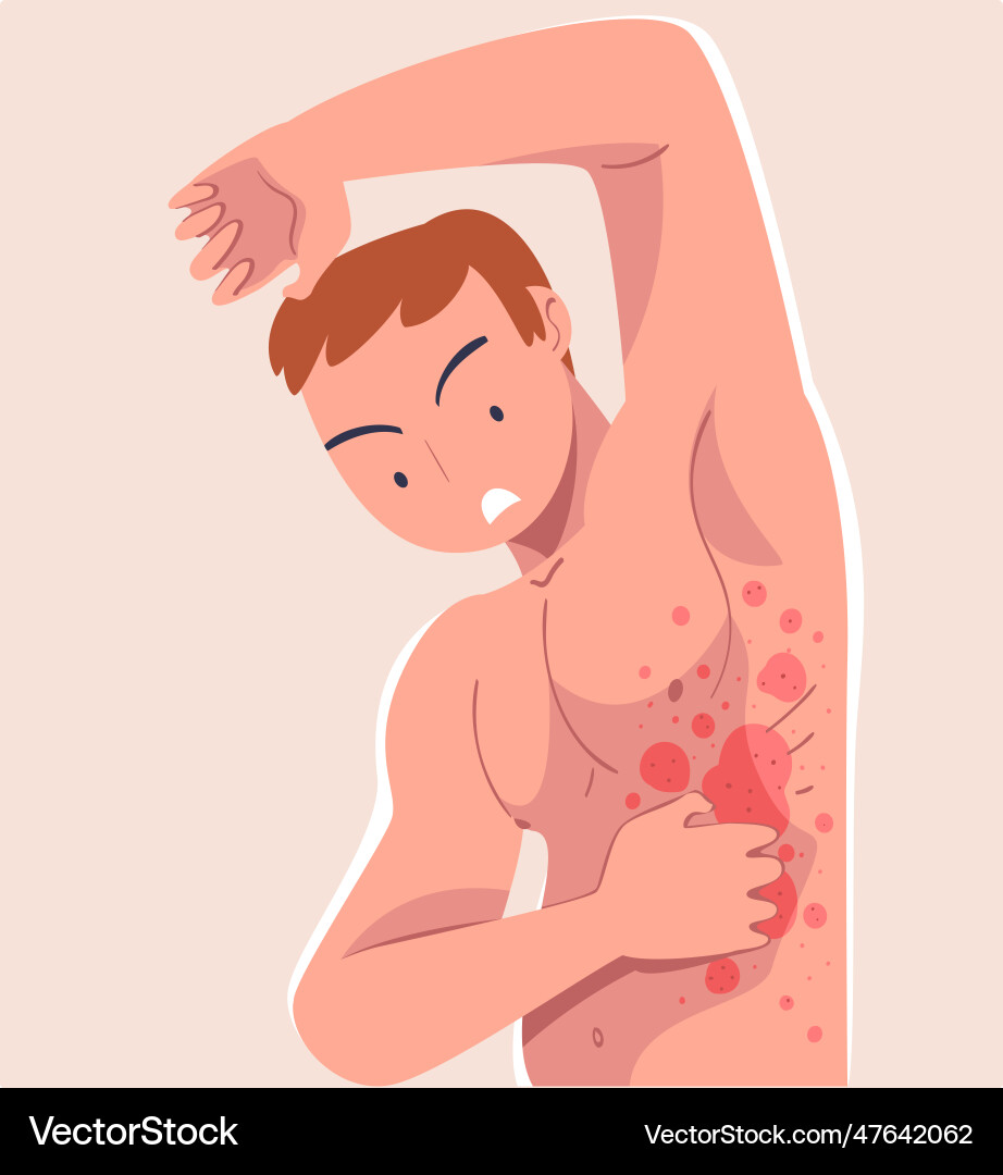 Man character with skin problem suffering Vector Image