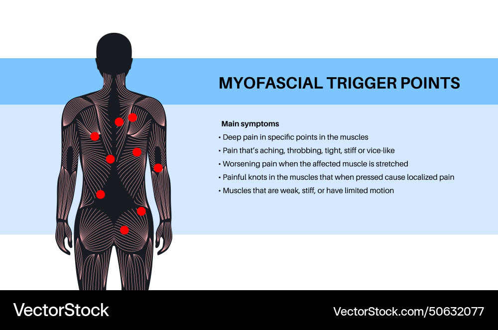 Myofascial trigger points vector image