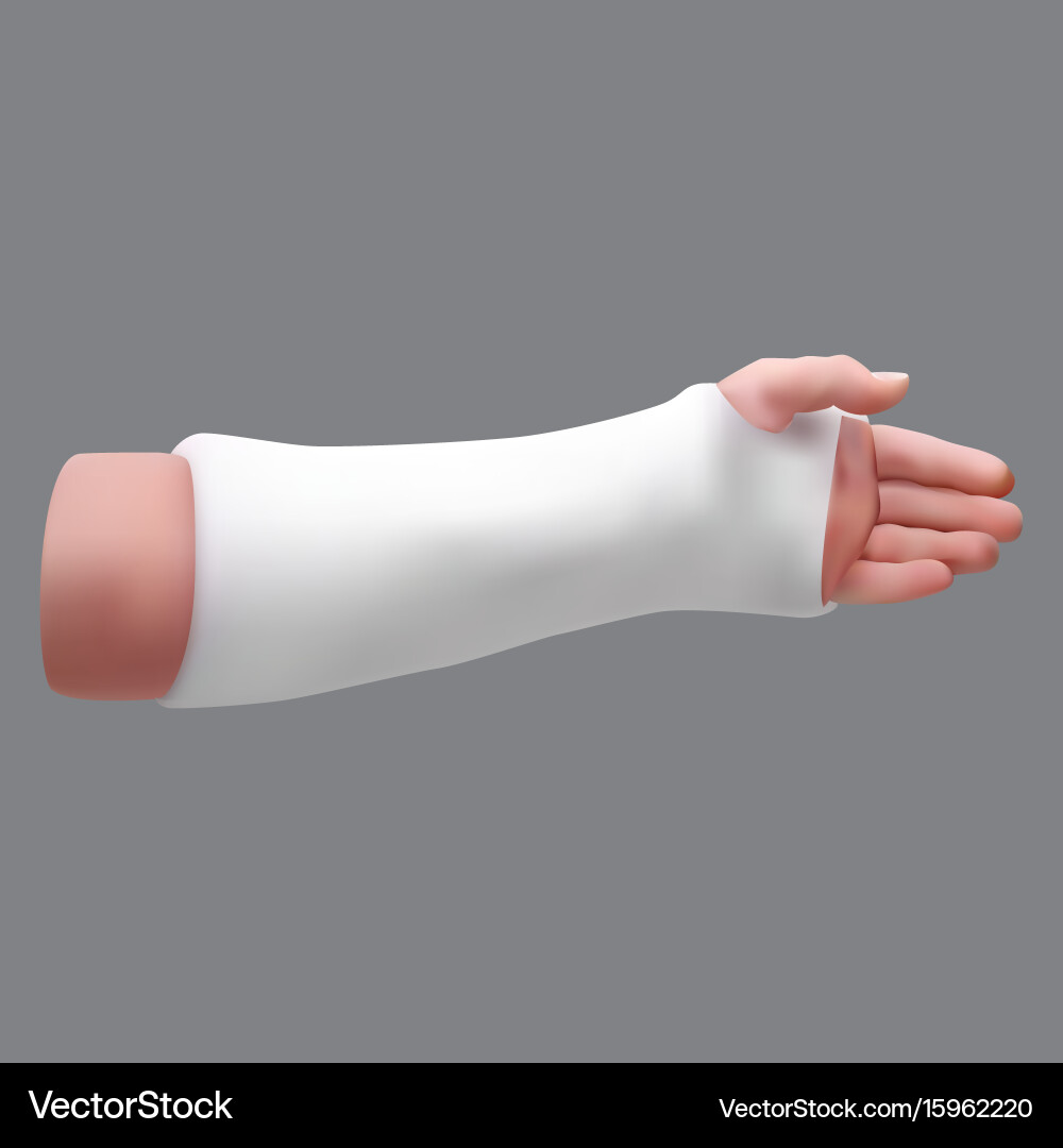 Gypsized broken arm isolated realistic object vector image