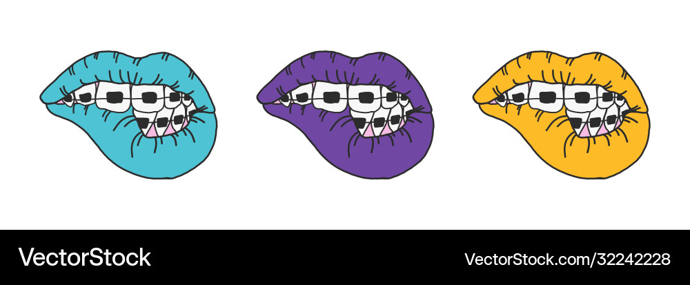 Sexy lips and teeth in braces Sexy lips and teeth in braces vector image